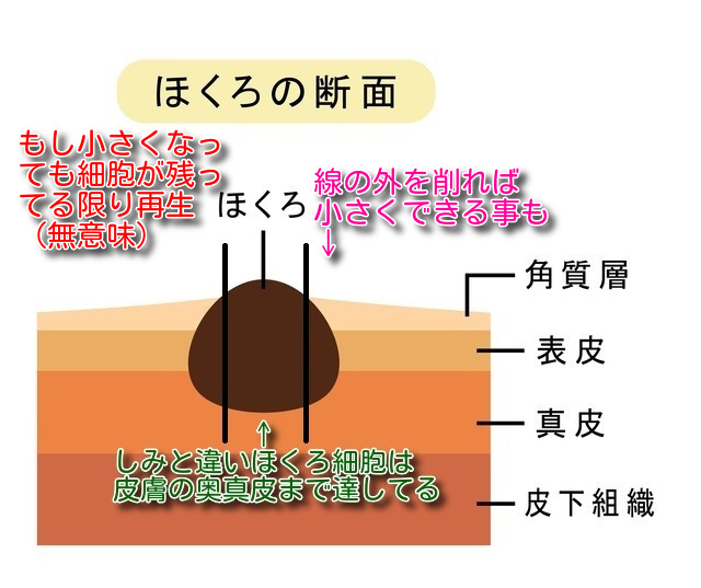 ほくろ を 小さく する 方法