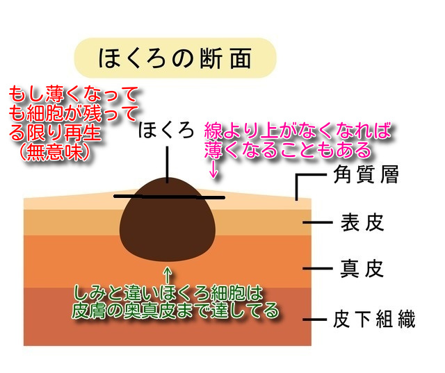 ほくろを薄くする方法